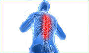 Back Pain